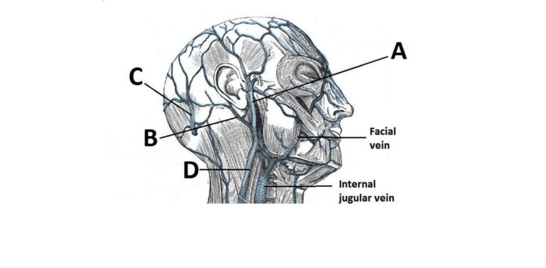 Lateral head diagram with veins A, B, C, D and the facial vein/internal jugular vein labelled