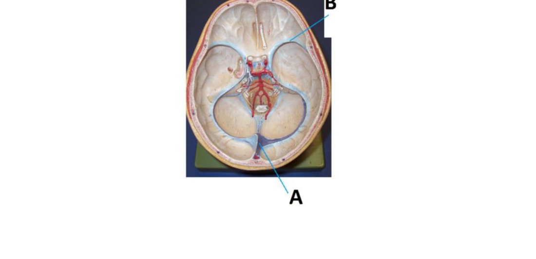 Base of skull with dural venous sinuses A and B labelled