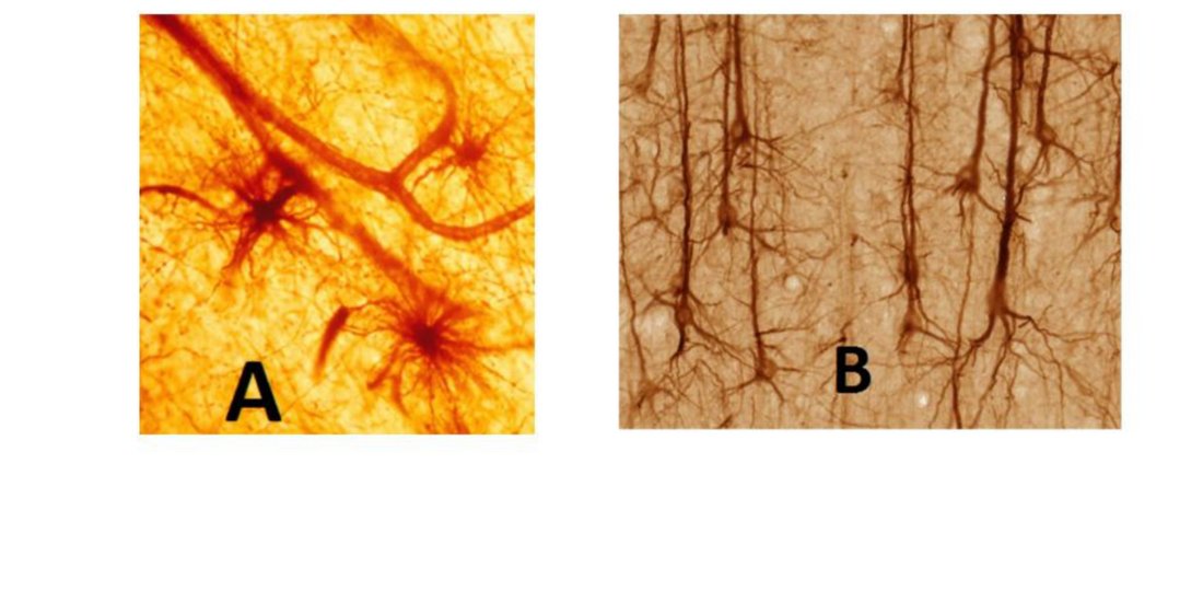 Histology slides of astrocytes (A) and pyramidal neurons (B)