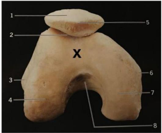 Distal femur specimen marked X