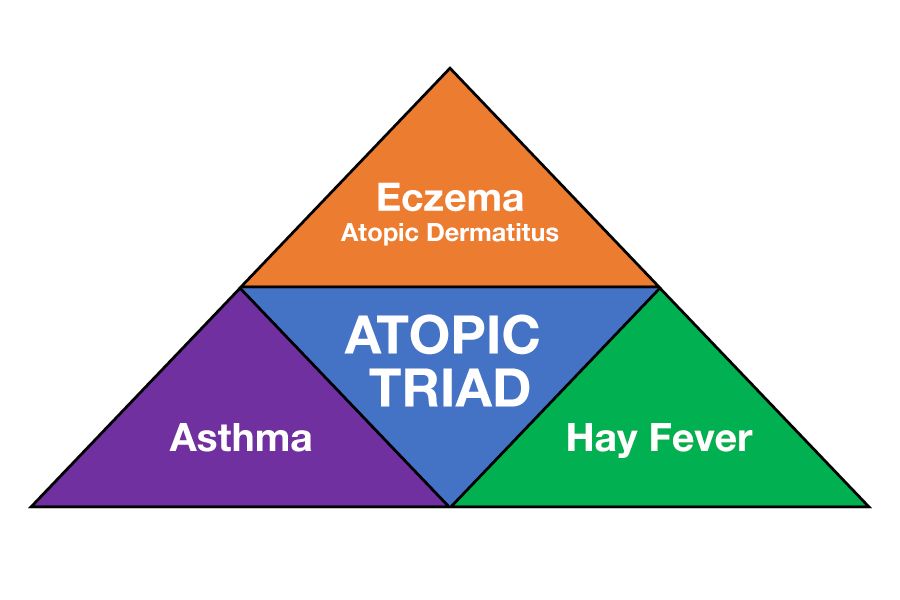 Drug triggers of asthma