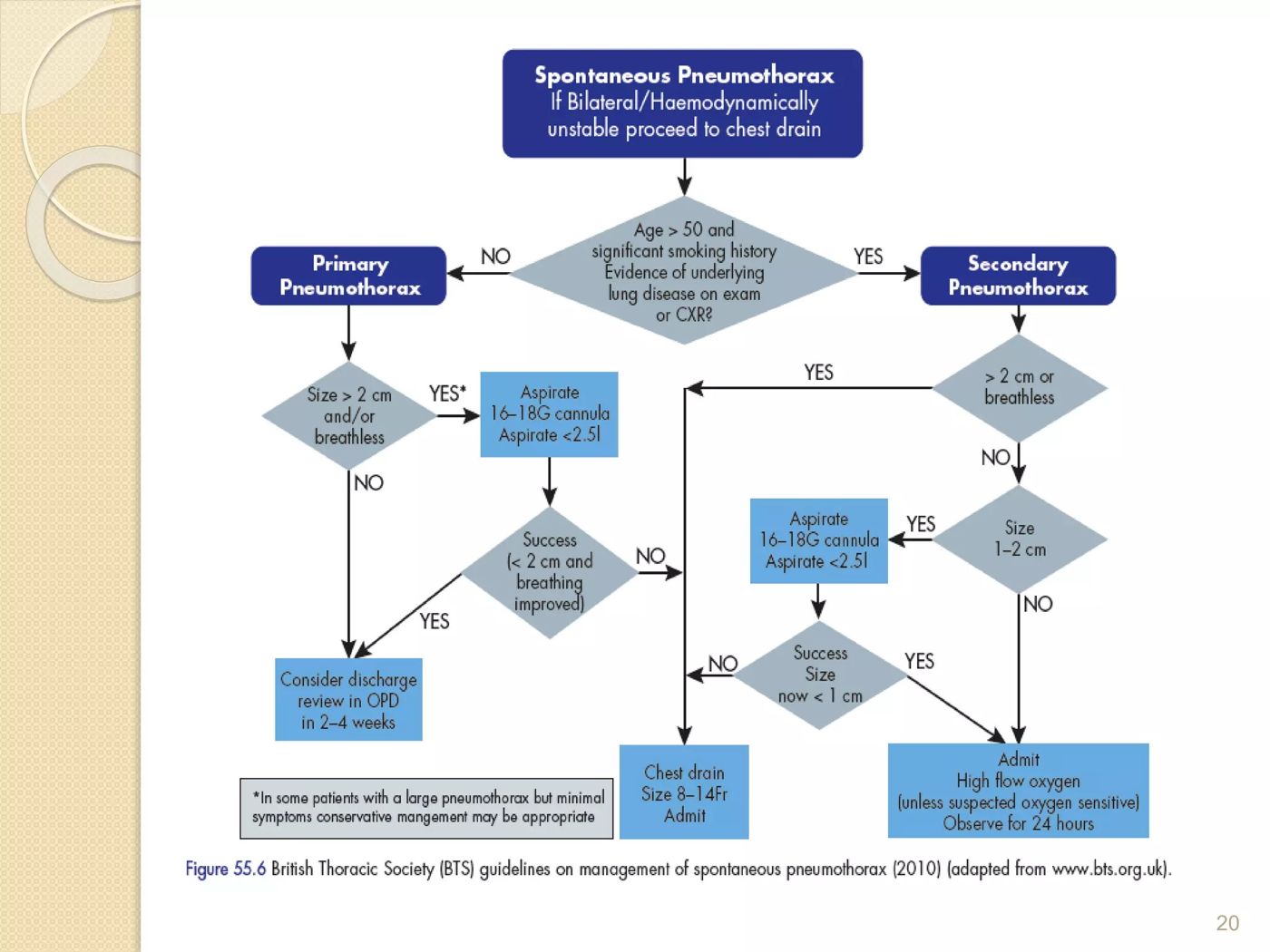 BTS guideline for spontaneous pneumothorax